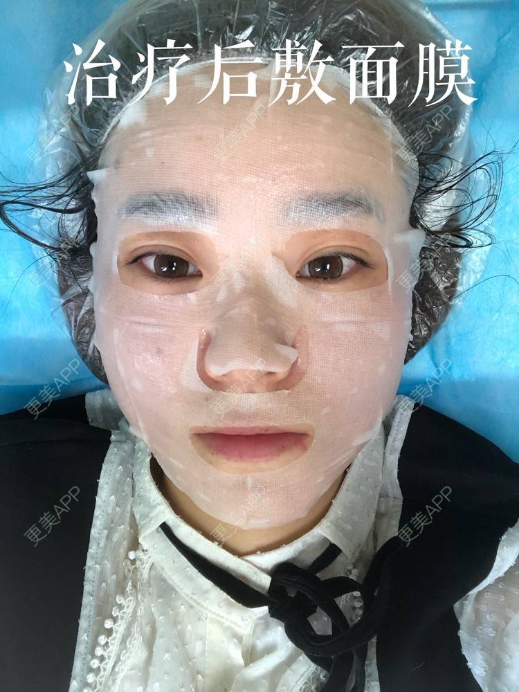 更美 - 田小雕的热玛吉经验 | 热玛吉 | 宁波