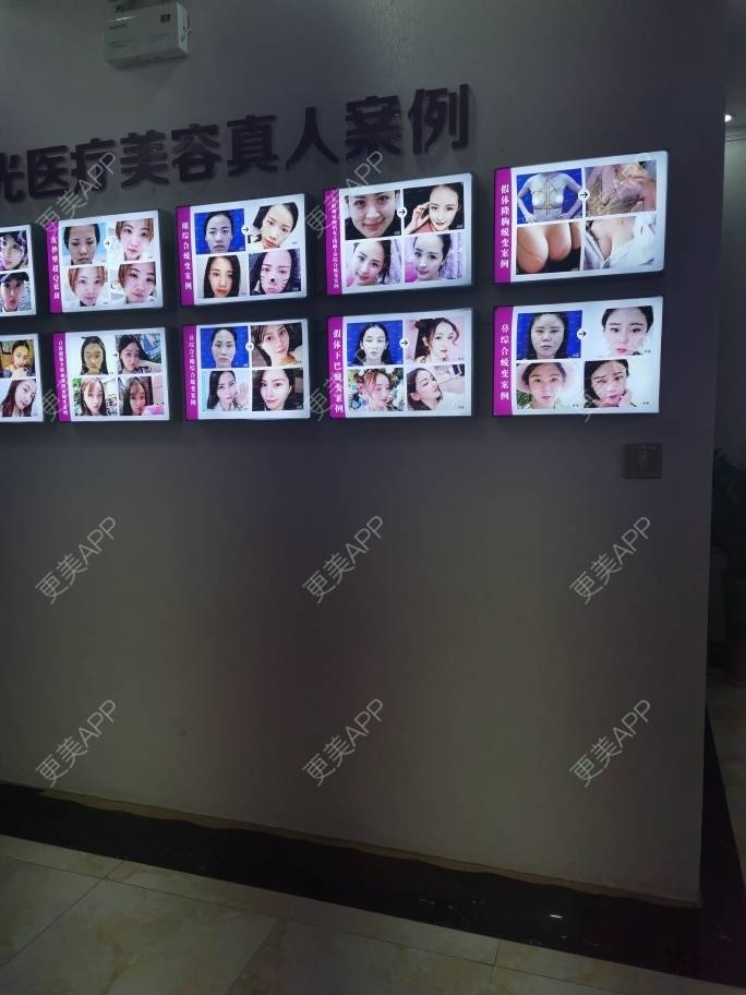 更美 - 更美用户1iaU3ZYqPa的玻尿酸下巴经验 | 玻尿酸下巴 | 南昌