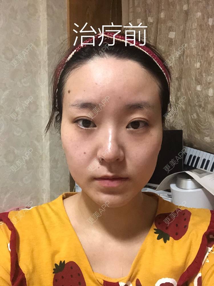 更美 - 田小雕的热玛吉经验 | 热玛吉 | 宁波