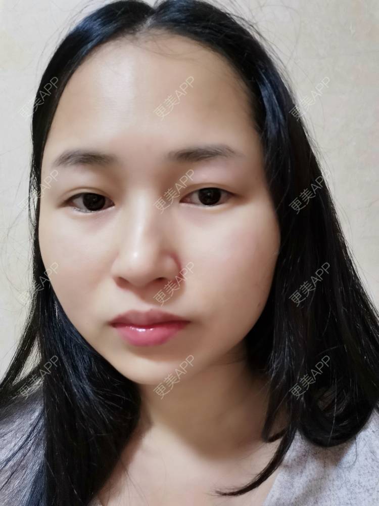 更美 - 小桃桃源的清洁水光补水经验 | 清洁水光补水 | 广州 | 皮肤综合管理套餐