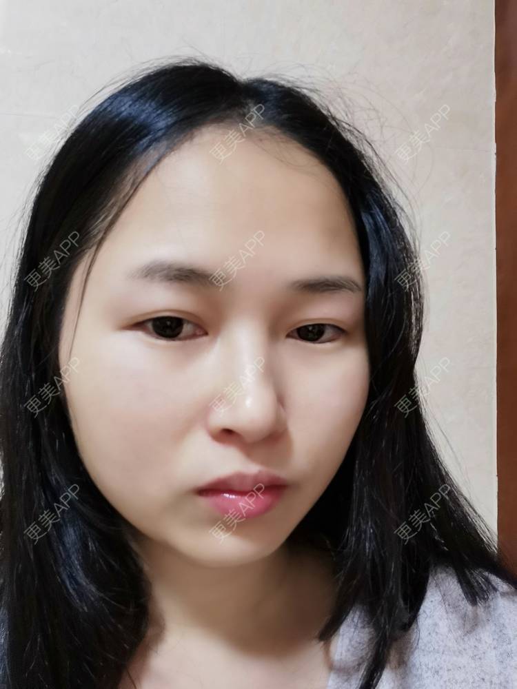 更美 - 小桃桃源的清洁水光补水经验 | 清洁水光补水 | 广州 | 皮肤综合管理套餐