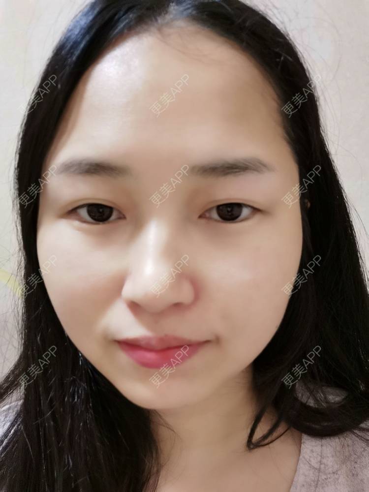 更美 - 小桃桃源的清洁水光补水经验 | 清洁水光补水 | 广州 | 皮肤综合管理套餐