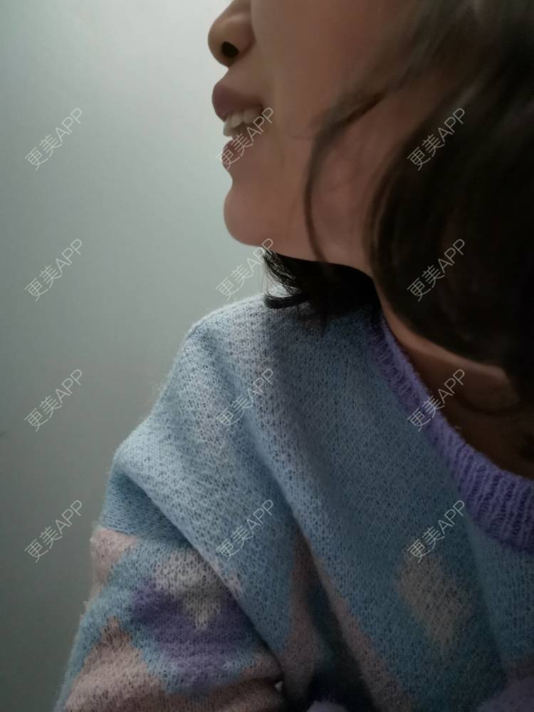 更美 - 更美用户YWdQyE2kiR的金属托槽矫正经验 | 北京 | 金属托槽矫正