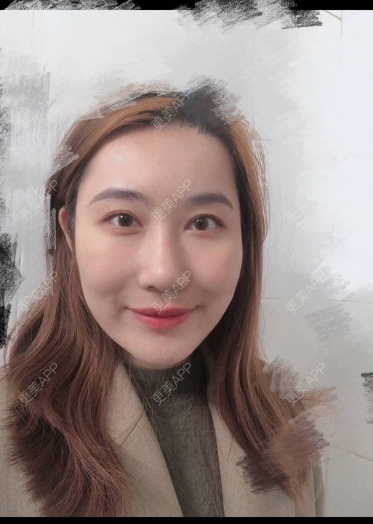 更美 - 会魔法的小仙女肛的鼻部多项经验 | 鼻部多项 | 河源
