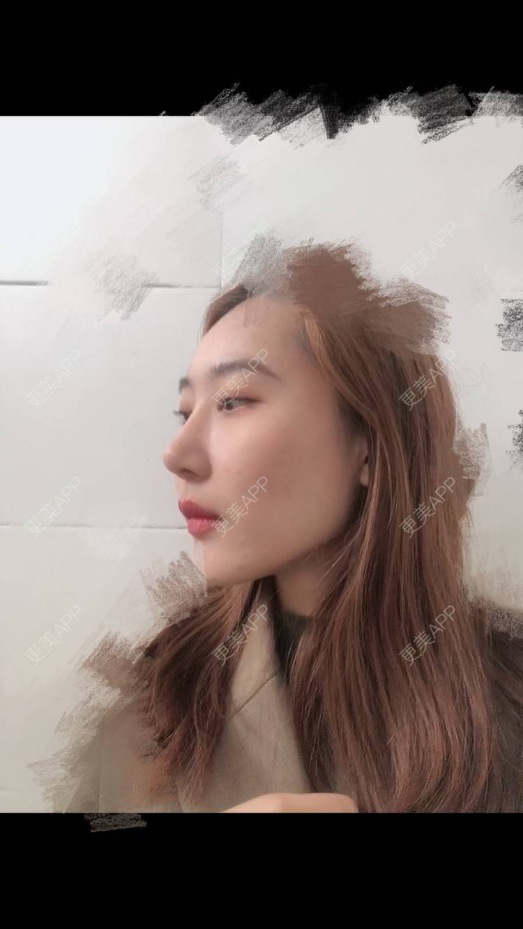 更美 - 会魔法的小仙女肛的鼻部多项经验 | 鼻部多项 | 河源