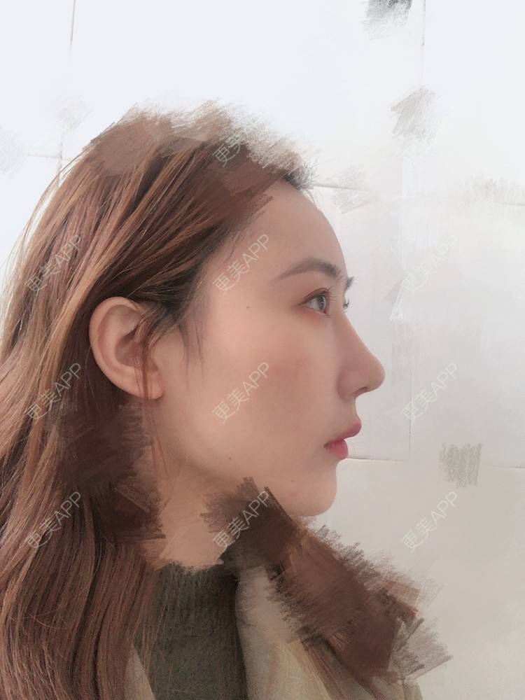 更美 - 会魔法的小仙女肛的鼻部多项经验 | 鼻部多项 | 河源