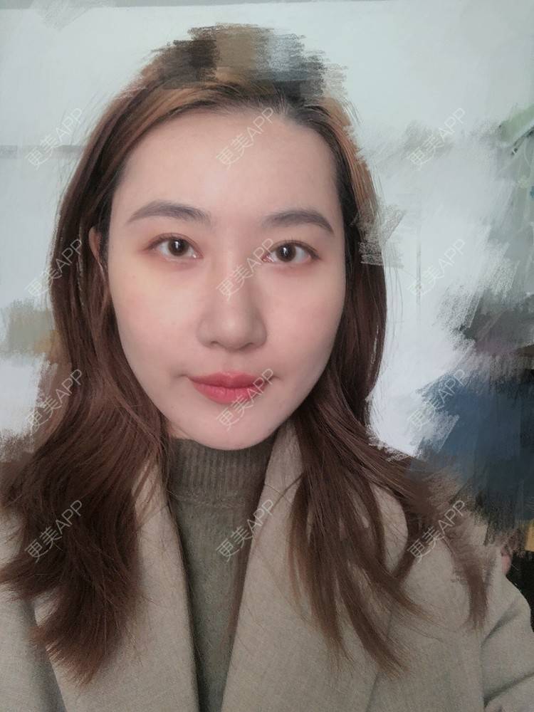 更美 - 会魔法的小仙女肛的鼻部多项经验 | 鼻部多项 | 河源