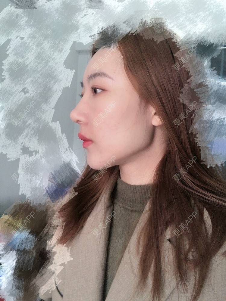 更美 - 会魔法的小仙女肛的鼻部多项经验 | 鼻部多项 | 河源
