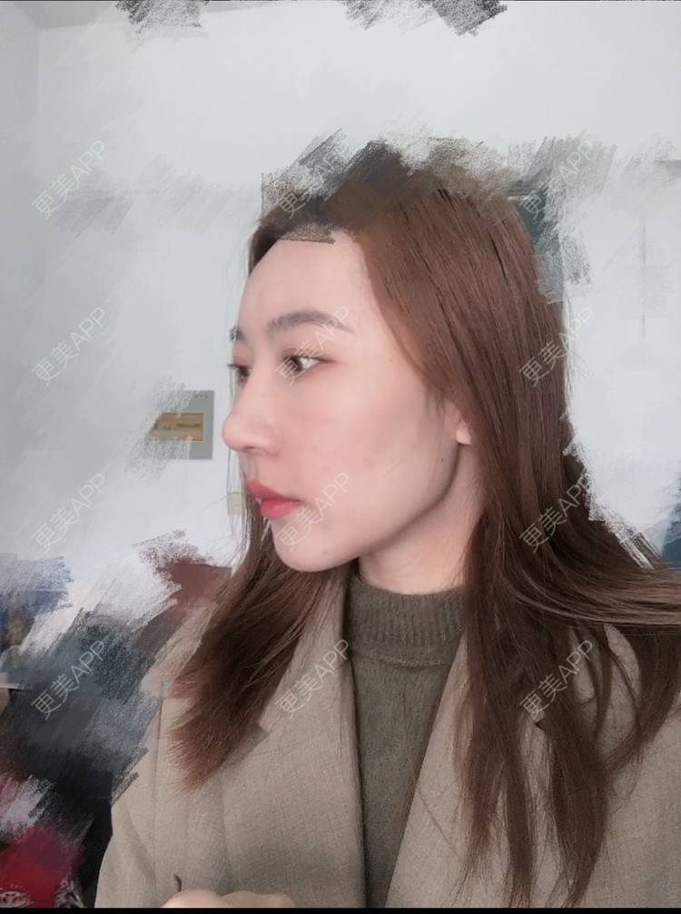 更美 - 会魔法的小仙女肛的鼻部多项经验 | 鼻部多项 | 河源