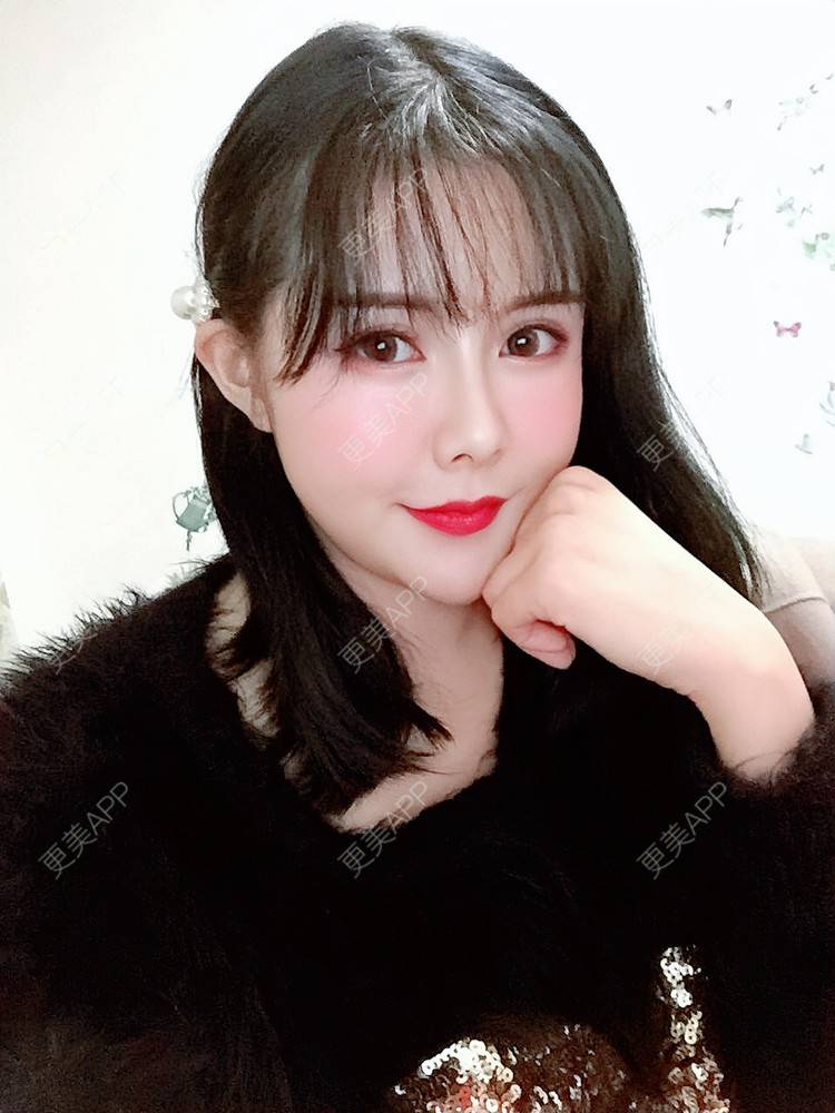 更美 - Daisy11的自体脂肪全面部填充经验 | 自体脂肪全面部填充 | 视频日记 | 重庆