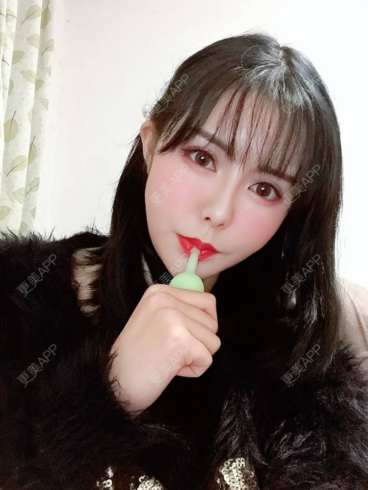 更美 - Daisy11的自体脂肪全面部填充经验 | 自体脂肪全面部填充 | 视频日记 | 重庆
