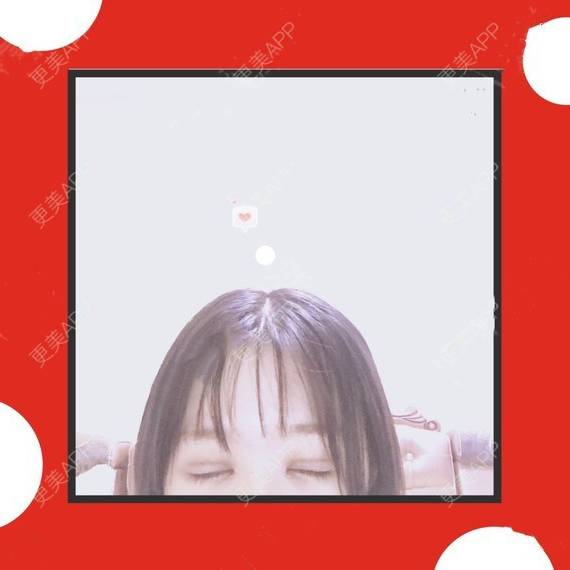 更美 - 更美用户QhVYqz6e5S的双眼皮经验 | 上海 | 双眼皮