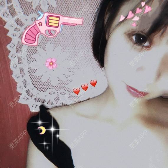 更美 - 更美用户QhVYqz6e5S的双眼皮经验 | 上海 | 双眼皮