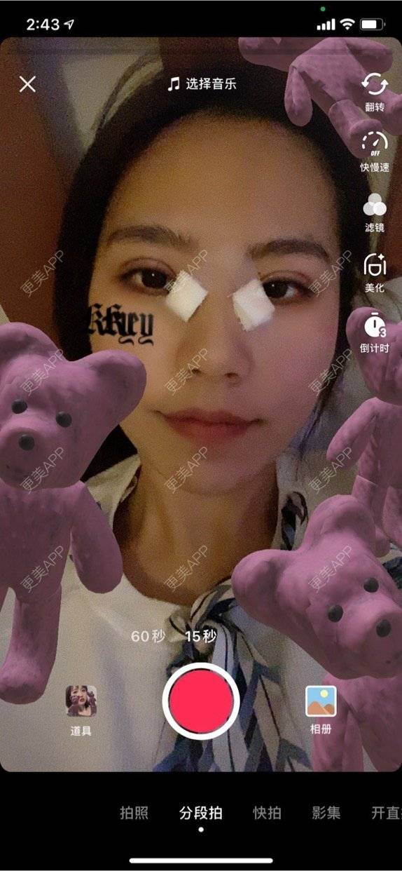 更美 - 更美用户LlGf9K7w9y的眼部多项经验 | 青岛 | 眼部多项