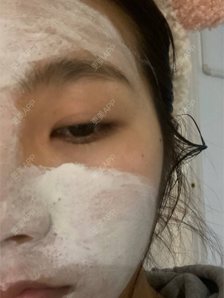 更美 - 更美用户LlGf9K7w9y的眼部多项经验 | 青岛 | 眼部多项