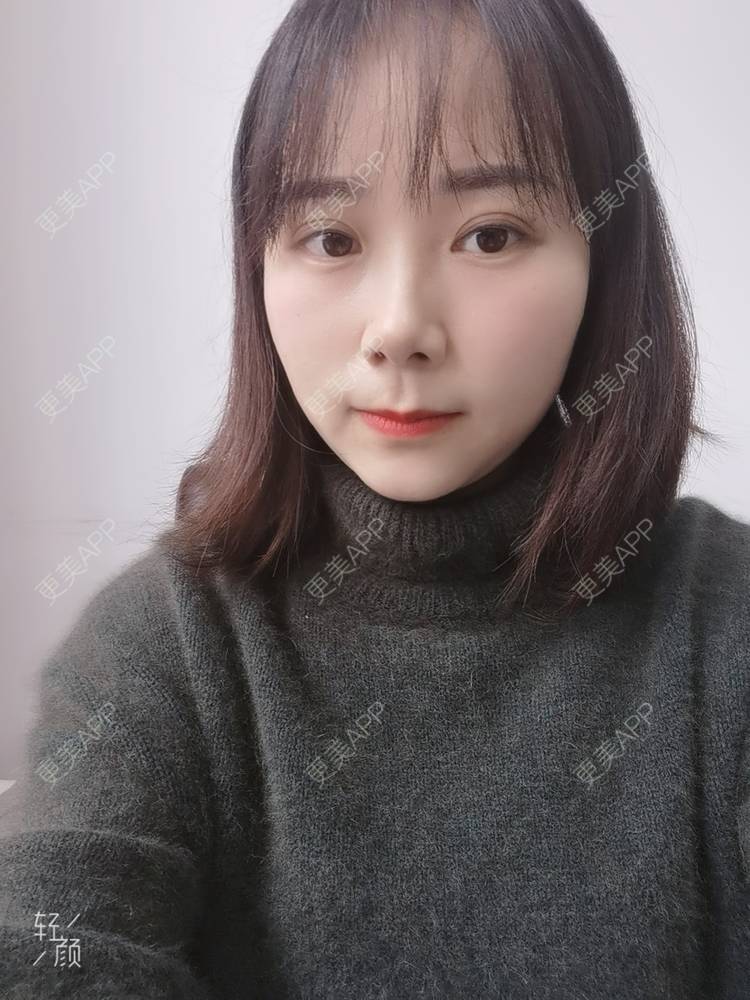 更美 - 更美用户2xnQj47lDg的眼部综合经验 | 眼部综合 | 重庆