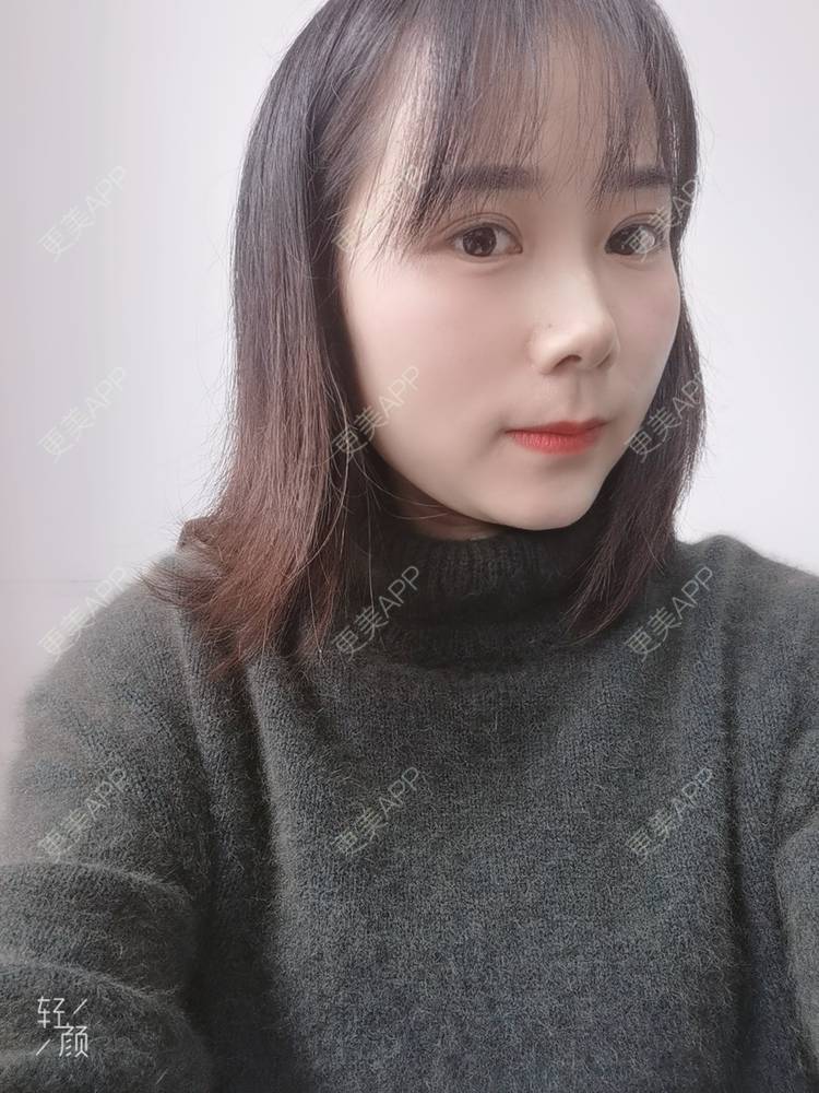 更美 - 更美用户2xnQj47lDg的眼部综合经验 | 眼部综合 | 重庆