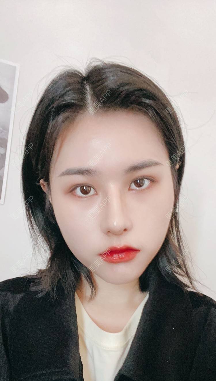 更美 - ヌ酷还可爱ˇ男的鼻部多项经验 | 鼻部多项 | 重庆