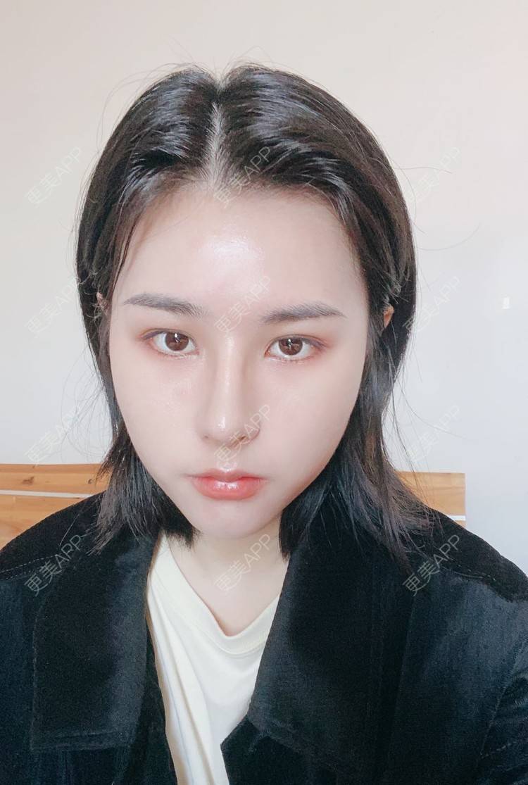 更美 - ヌ酷还可爱ˇ男的鼻部多项经验 | 鼻部多项 | 重庆