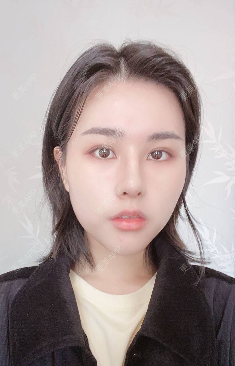 更美 - ヌ酷还可爱ˇ男的鼻部多项经验 | 鼻部多项 | 重庆