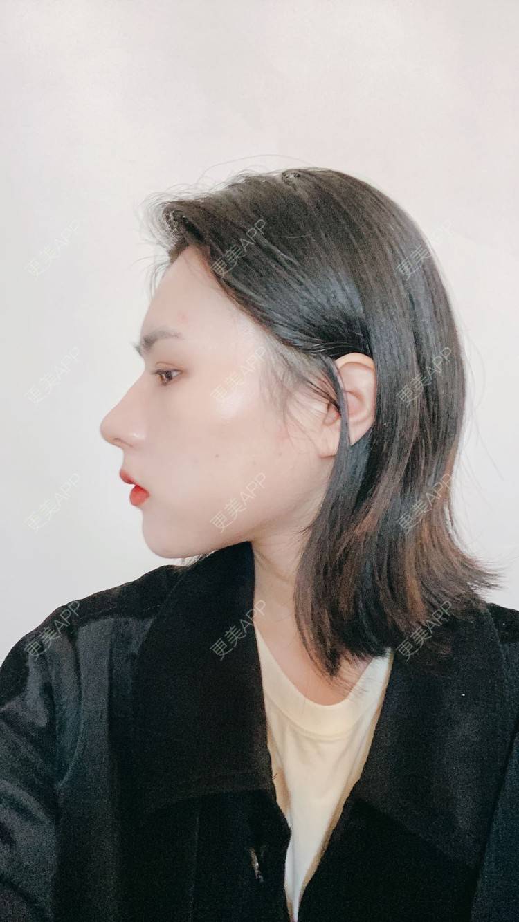 更美 - ヌ酷还可爱ˇ男的鼻部多项经验 | 鼻部多项 | 重庆