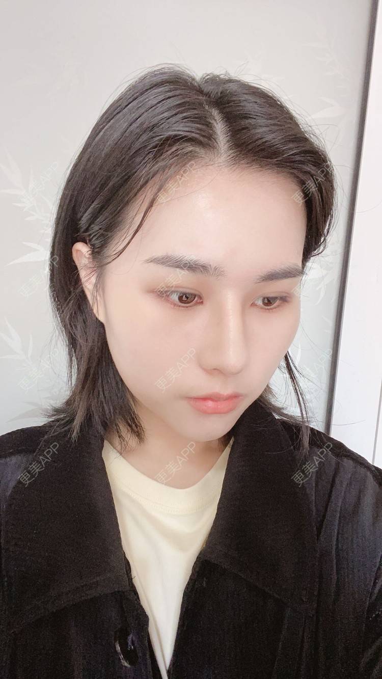 更美 - ヌ酷还可爱ˇ男的鼻部多项经验 | 鼻部多项 | 重庆