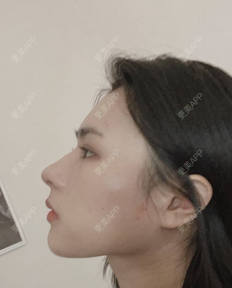 更美 - ヌ酷还可爱ˇ男的鼻部多项经验 | 鼻部多项 | 重庆