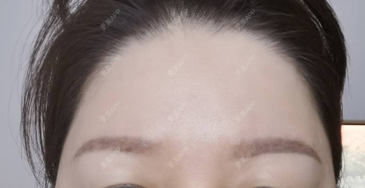 更美 - baoXbao的皮秒激光经验 | 皮秒激光 | 广州