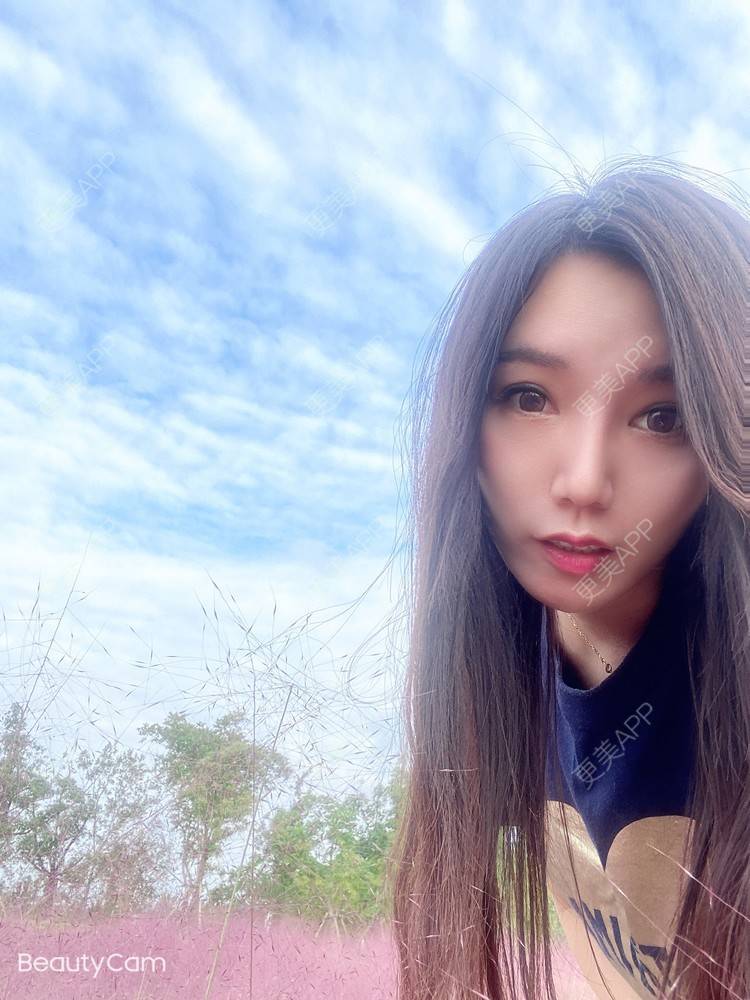 更美 - 傻傻傻分不清的硅胶垫下巴经验 | 硅胶垫下巴 | 上海