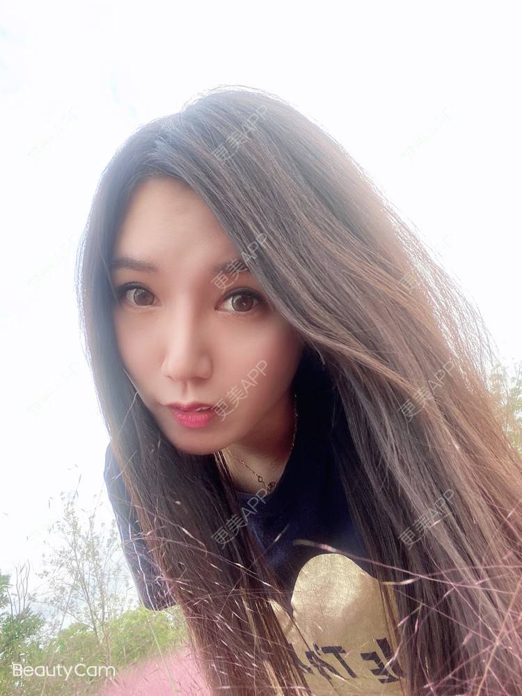 更美 - 傻傻傻分不清的硅胶垫下巴经验 | 硅胶垫下巴 | 上海