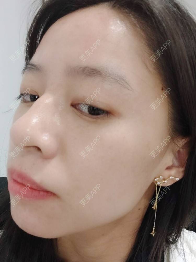 更美 - 更美用户FKgNeqD2Py的黑脸娃娃经验 | 光子嫩肤 | 白瓷娃娃 | 黑脸娃娃 | 彩光嫩肤 | 美白导入 | 点阵激光 | 注射美白 | 镭射净肤 | 果酸焕肤 | 激光淡斑 | 美白套餐 | 重庆