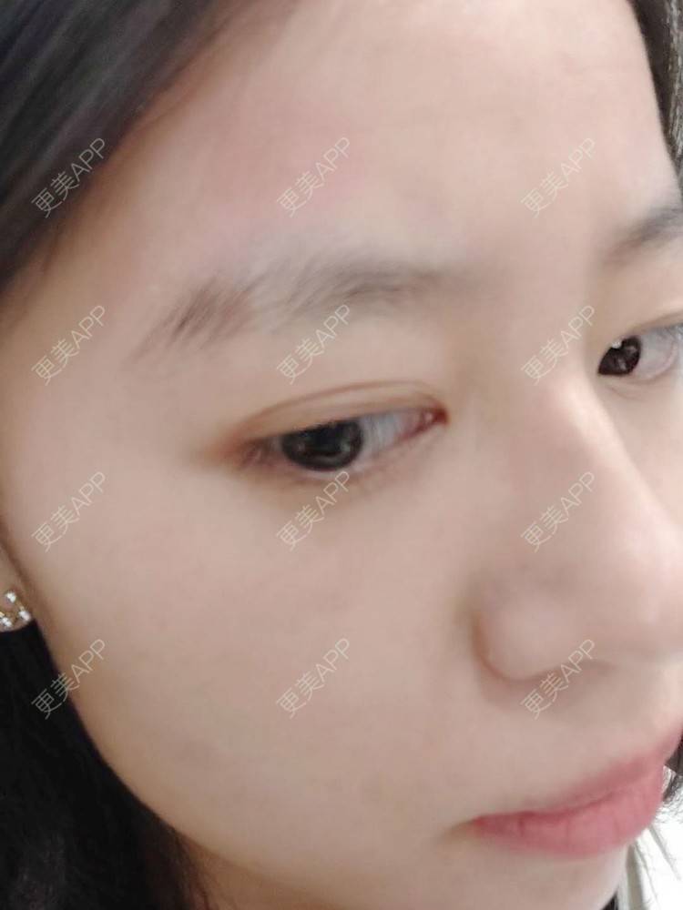 更美 - 更美用户FKgNeqD2Py的黑脸娃娃经验 | 光子嫩肤 | 白瓷娃娃 | 黑脸娃娃 | 彩光嫩肤 | 美白导入 | 点阵激光 | 注射美白 | 镭射净肤 | 果酸焕肤 | 激光淡斑 | 美白套餐 | 重庆