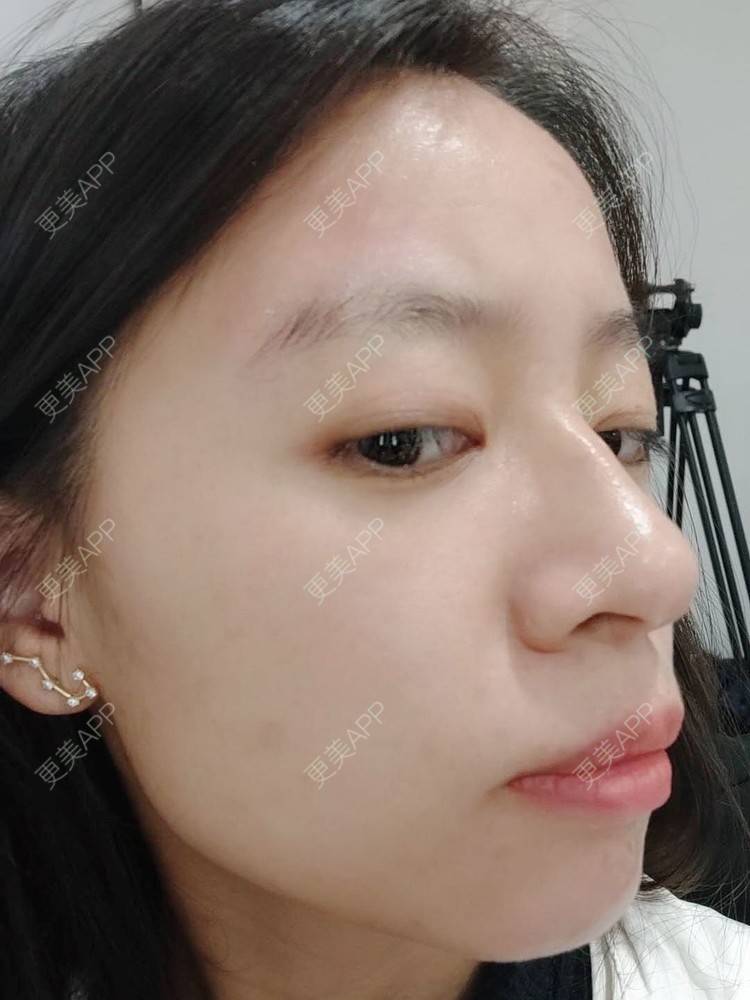 更美 - 更美用户FKgNeqD2Py的黑脸娃娃经验 | 光子嫩肤 | 白瓷娃娃 | 黑脸娃娃 | 彩光嫩肤 | 美白导入 | 点阵激光 | 注射美白 | 镭射净肤 | 果酸焕肤 | 激光淡斑 | 美白套餐 | 重庆