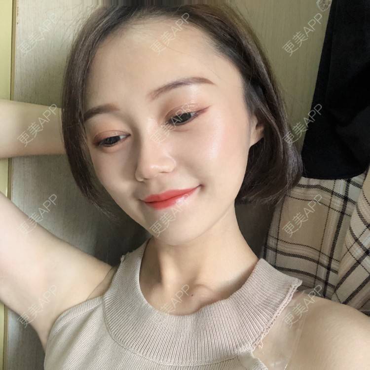 更美 - 午午的下颌角经验 | 成都 | 视频日记 | 下颌角
