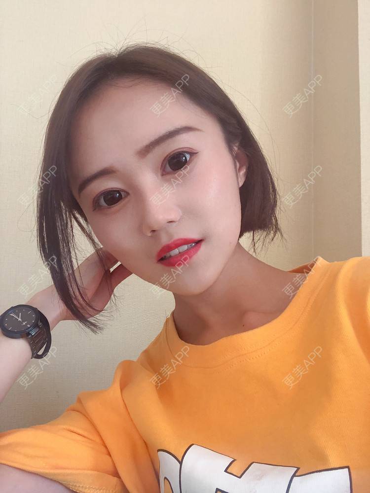 更美 - 午午的下颌角经验 | 成都 | 视频日记 | 下颌角