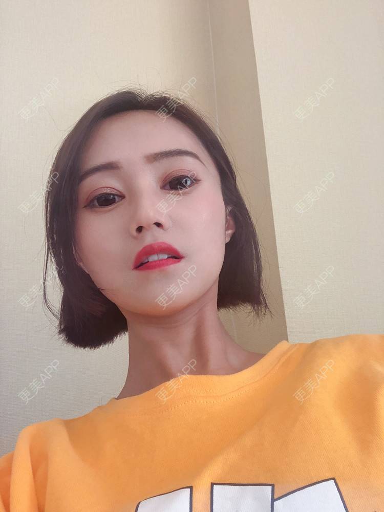 更美 - 午午的下颌角经验 | 成都 | 视频日记 | 下颌角