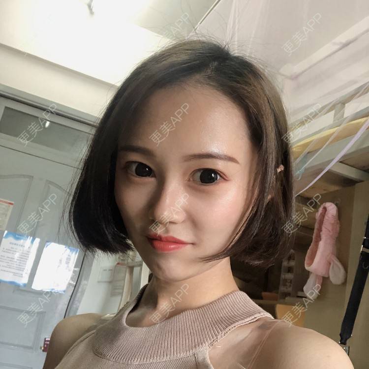 更美 - 午午的下颌角经验 | 成都 | 视频日记 | 下颌角