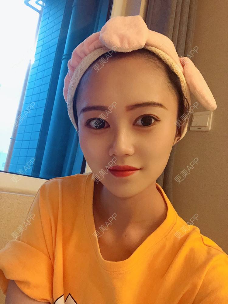 更美 - 午午的下颌角经验 | 成都 | 视频日记 | 下颌角