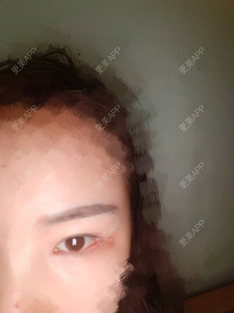 更美 - 🤘🏼☝🏼✋🏼🖐🏼🖖🏼的眼部多项经验 | 长春 | 眼部多项