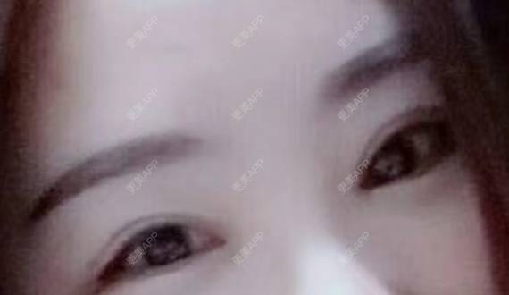 更美 - 🤘🏼☝🏼✋🏼🖐🏼🖖🏼的眼部多项经验 | 长春 | 眼部多项