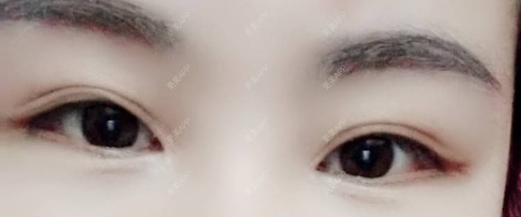 更美 - 🤘🏼☝🏼✋🏼🖐🏼🖖🏼的眼部多项经验 | 长春 | 眼部多项