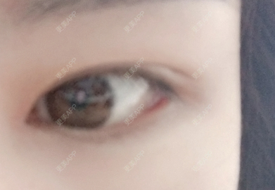 更美 - 🤘🏼☝🏼✋🏼🖐🏼🖖🏼的眼部多项经验 | 长春 | 眼部多项