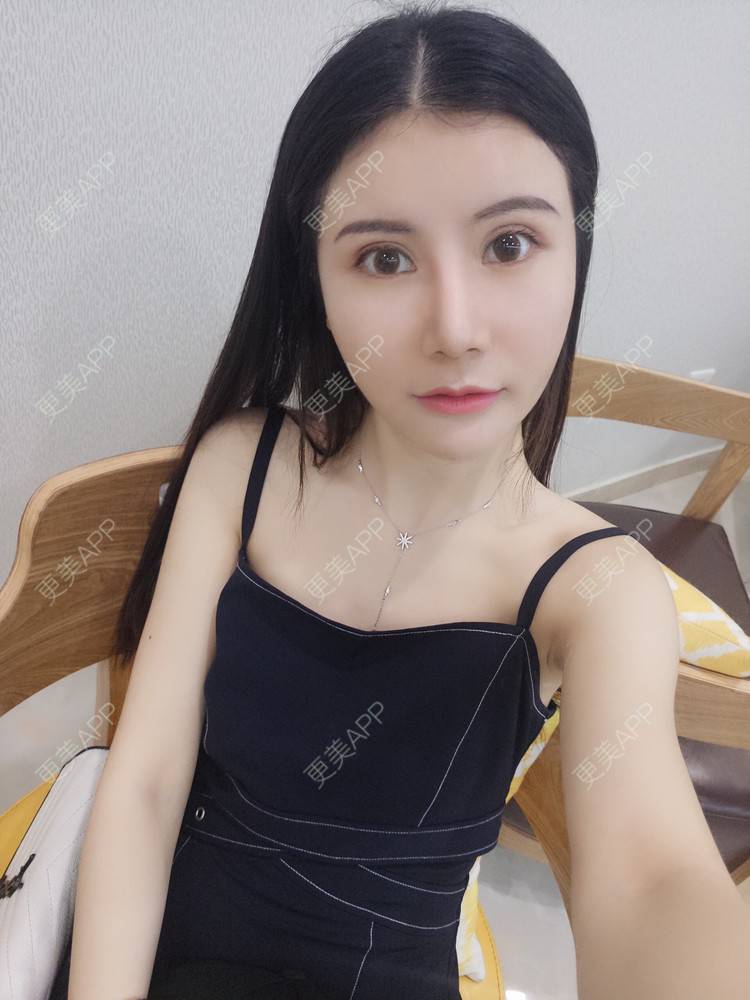 更美 - 圆圆园小姐姐的PRP自体血清美肤经验 | PRP自体血清美肤 | 广州 | 视频日记