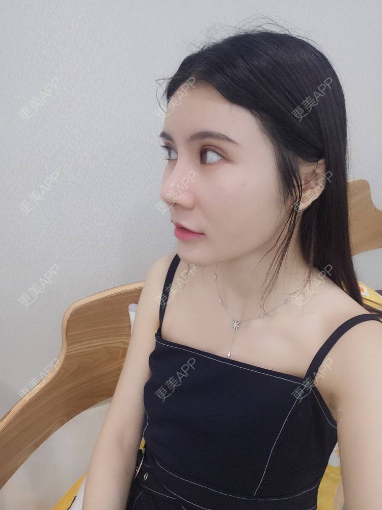 更美 - 圆圆园小姐姐的PRP自体血清美肤经验 | PRP自体血清美肤 | 广州 | 视频日记
