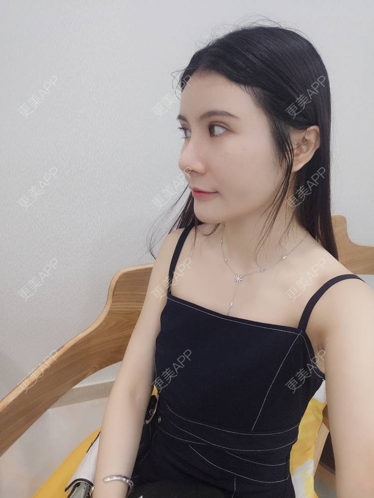 更美 - 圆圆园小姐姐的PRP自体血清美肤经验 | PRP自体血清美肤 | 广州 | 视频日记