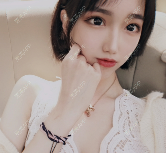 更美 - 灬爱笑のгeη哭ぅ肆的自体脂肪丰苹果肌经验 | 自体脂肪丰苹果肌 | 长沙