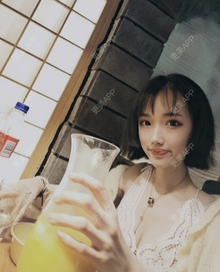 更美 - 灬爱笑のгeη哭ぅ肆的自体脂肪丰苹果肌经验 | 自体脂肪丰苹果肌 | 长沙