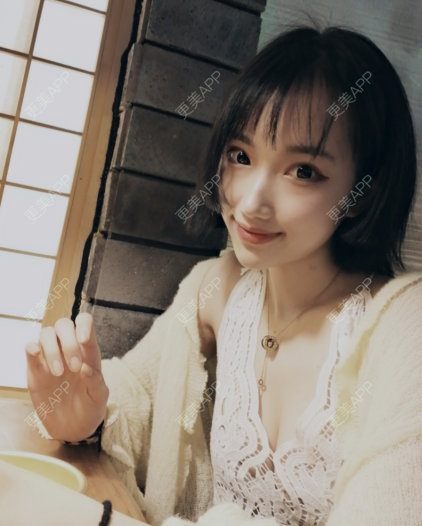 更美 - 灬爱笑のгeη哭ぅ肆的自体脂肪丰苹果肌经验 | 自体脂肪丰苹果肌 | 长沙