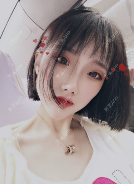 更美 - 灬爱笑のгeη哭ぅ肆的自体脂肪丰苹果肌经验 | 自体脂肪丰苹果肌 | 长沙