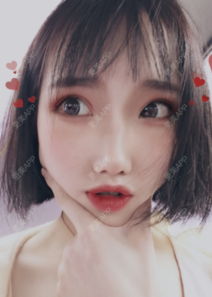 更美 - 灬爱笑のгeη哭ぅ肆的自体脂肪丰苹果肌经验 | 自体脂肪丰苹果肌 | 长沙